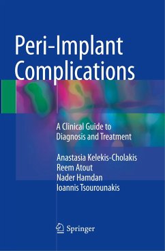 Peri-Implant Complications - Kelekis-Cholakis, Anastasia;Atout, Reem;Hamdan, Nader