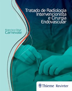 Tratado de radiologia intervencionista e cirurgia endovascular (eBook, ePUB) - Carnevale, Francisco César