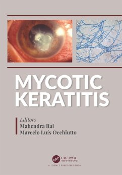 Mycotic Keratitis (eBook, PDF)