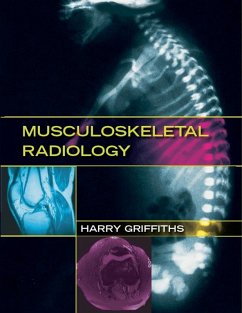 Musculoskeletal Radiology (eBook, ePUB) - Griffiths, Harry