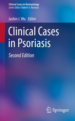 Clinical Cases in Psoriasis (eBook, PDF)