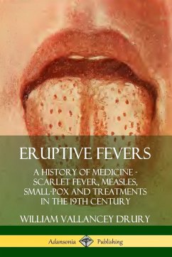 Eruptive Fevers - Drury, William Vallancey