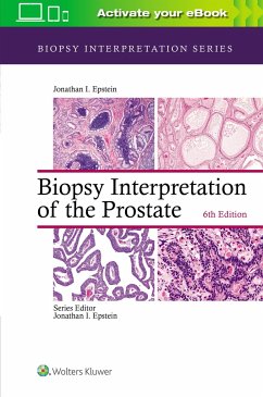 Biopsy Interpretation of the Prostate - Epstein, Jonathan I.