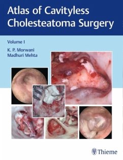 Atlas of Cavityless Cholesteatoma Surgery, Vol 1 - Morwani, K;Mehta, Madhuri