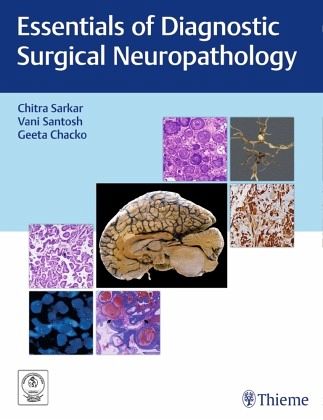 Essentials of Diagnostic Surgical Neuropathology
