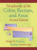 Neoplasms of the Colon, Rectum, and Anus (eBook, ePUB)