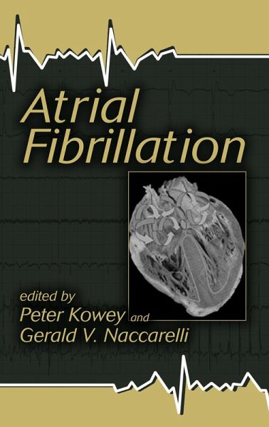 Atrial Fibrillation (eBook, ePUB) Atrial Fibrillation (eBook, ePUB)