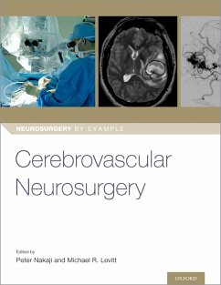 Cover Cerebrovascular Neurosurgery (eBook, ePUB)
