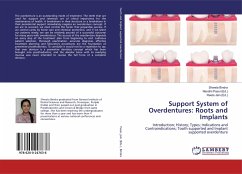 Support System of Overdentures: Roots and Implants - Bindra, Shweta