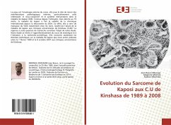 Evolution du Sarcome de Kaposi aux C.U de Kinshasa de 1989 à 2008 - Mbongu, Jean Bosco;Mbenza, Magloire;Mbombo, Nadine