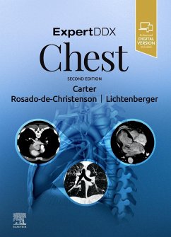 Expertddx: Chest - Carter, Brett W; Rosado-De-Christenson, Melissa L; Lichtenberger III, John P; Martínez-Jiménez, Santiago