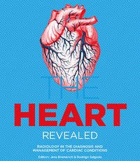 The HEART revealed - Jens Bremerich & Rodrigo Salgado