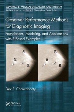 Observer Performance Methods for Diagnostic Imaging (eBook, PDF) - Chakraborty, Dev P.