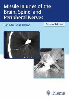 Missile Injuries of the Brain, Spine, and Peripheral Nerves - Bhatoe, Harjinder Singh