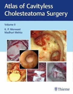 Atlas of Cavityless Cholesteatoma Surgery, Vol 2 - Morwani, K;Mehta, Madhuri