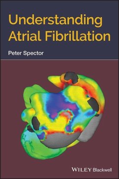 Understanding Atrial Fibrillation (eBook, PDF) - Spector, Peter