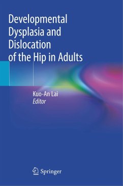 Developmental Dysplasia and Dislocation of the Hip in Adults