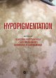 Hypopigmentation (eBook, ePUB) - Bild 1