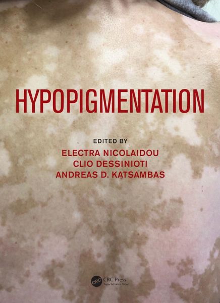 Hypopigmentation (eBook, ePUB)