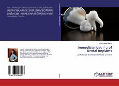 Immediate loading of Dental Implants