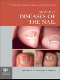 An Atlas of Diseases of the Nail (eBook, ePUB)