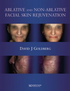 Ablative and Non-ablative Facial Skin Rejuvenation (eBook, ePUB) - Goldberg, David J.
