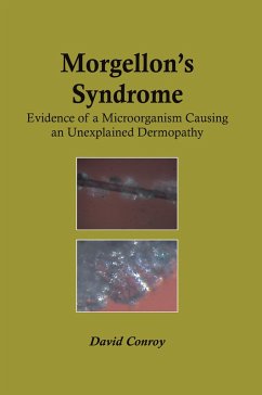 Cover Morgellon's Syndrome (eBook, PDF)