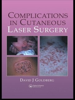 Complications in Laser Cutaneous Surgery (eBook, ePUB) - Goldberg, David J.