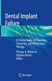 Dental Implant Failure (eBook, PDF)