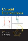Carotid Interventions (eBook, ePUB)