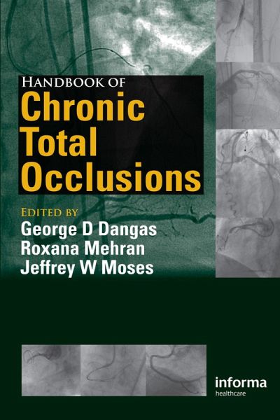 Handbook of Chronic Total Occlusions (eBook, ePUB)