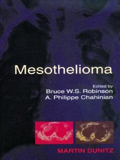 Cover Mesothelioma (eBook, ePUB)