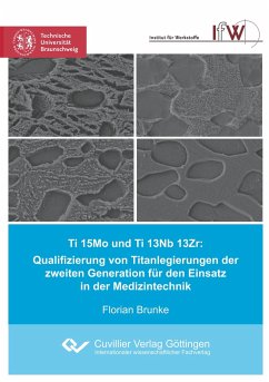 Ti 15Mo und Ti 13Nb 13Zr: Qualifizierung von Titanlegierungen der zweiten Generation für den Einsatz in der Medizintechnik - Brunke, Florian