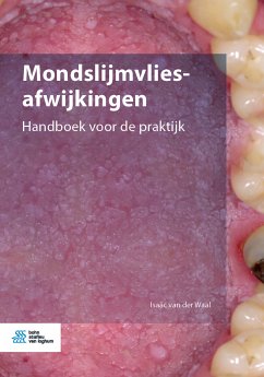 Mondslijmvliesafwijkingen (eBook, PDF) - van der Waal, Isaäc