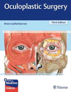 Oculoplastic Surgery (eBook, PDF) - Leatherbarrow, Brian
