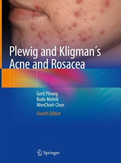 Plewig and Kligman´s Acne and Rosacea (eBook, PDF) - Plewig, Gerd; Melnik, Bodo; Chen, Wenchieh