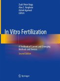 In Vitro Fertilization (eBook, PDF)