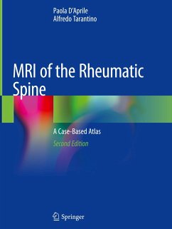 MRI of the Rheumatic Spine - D'Aprile, Paola;Tarantino, Alfredo