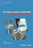 The Tibial Plateau Fractures: Diagnosis and Treatmment