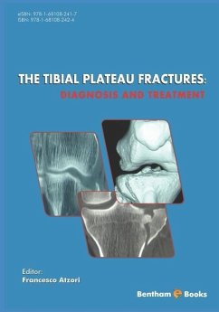 The Tibial Plateau Fractures: Diagnosis and Treatmment - Atzori, Francesco