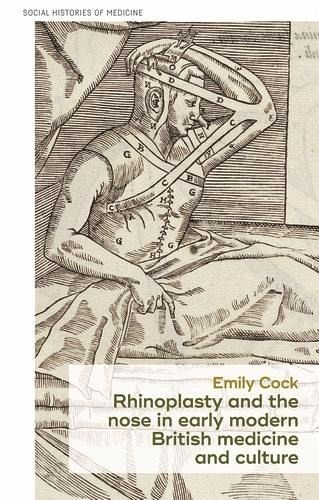 Rhinoplasty and the nose in early modern British medicine and culture (eBook, ePUB) Rhinoplasty and the nose in early modern British medicine and culture (eBook, ePUB)
