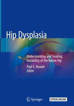 Hip Dysplasia