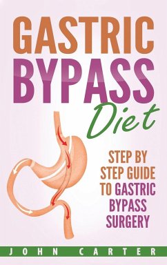 Gastric Bypass Diet - Carter, John