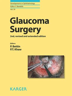 Glaucoma Surgery (eBook, ePUB)