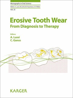 Erosive Tooth Wear (eBook, ePUB)