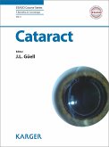 Cataract (eBook, ePUB)