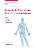 Buttonhole Cannulation (eBook, ePUB)