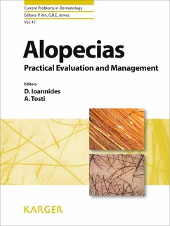 Alopecias - Practical Evaluation and Management (eBook, ePUB)