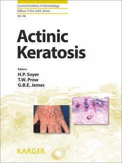 Cover Actinic Keratosis (eBook, ePUB)