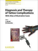 Diagnosis and Therapy of Tattoo Complications (eBook, ePUB)